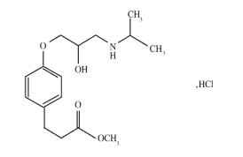 盐酸艾司洛尔注射液(齐鲁)