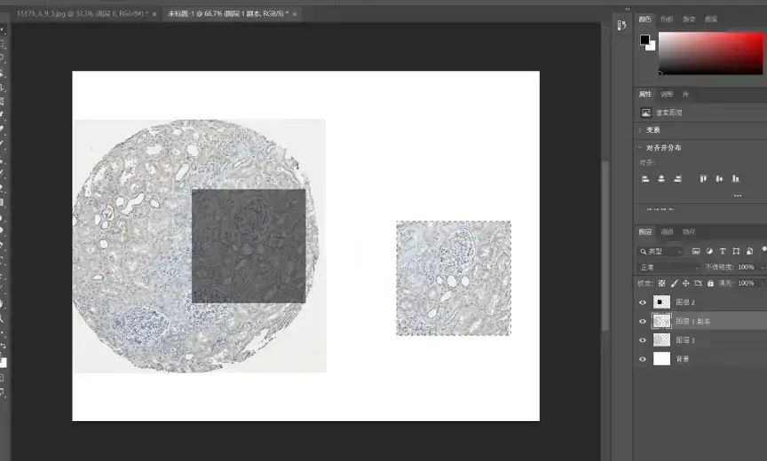解忧小工具|让HPA验证你的结论,生信文章好帮手