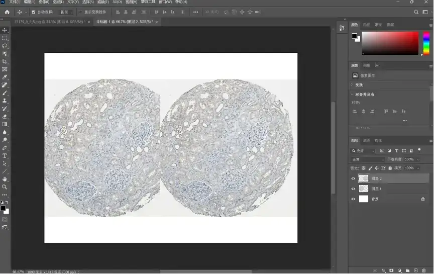 解忧小工具|让HPA验证你的结论,生信文章好帮手