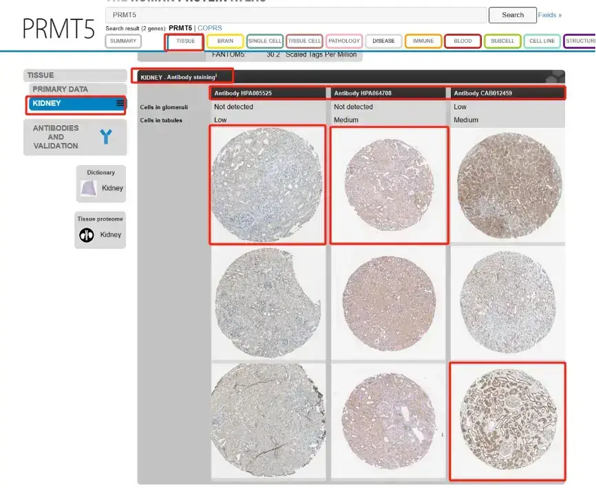 解忧小工具|让HPA验证你的结论,生信文章好帮手