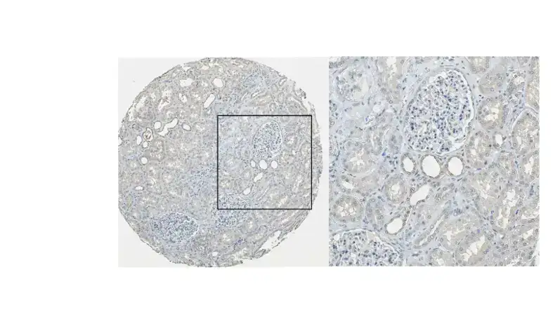 解忧小工具|让HPA验证你的结论,生信文章好帮手