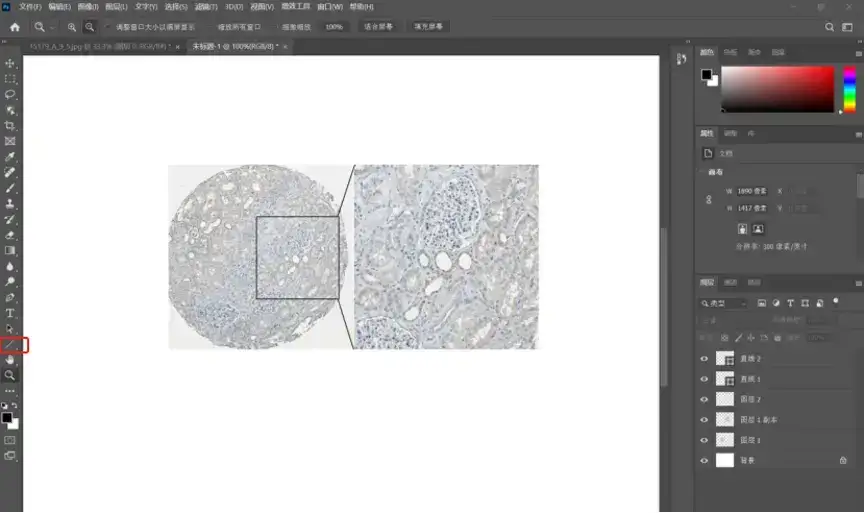 解忧小工具|让HPA验证你的结论,生信文章好帮手