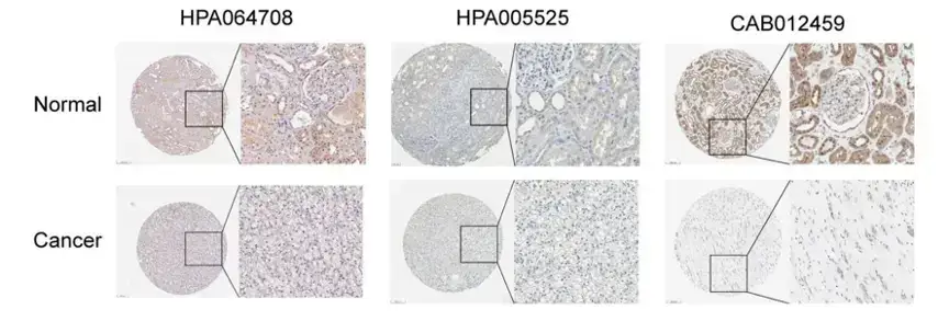 解忧小工具|让HPA验证你的结论,生信文章好帮手