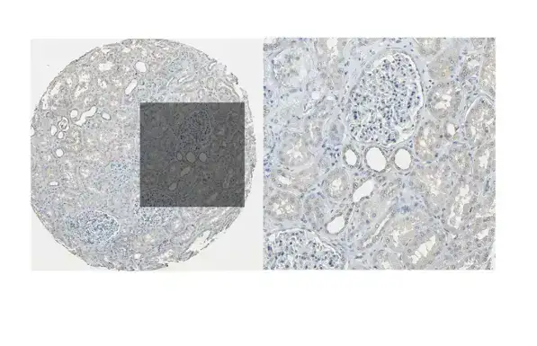 解忧小工具|让HPA验证你的结论,生信文章好帮手