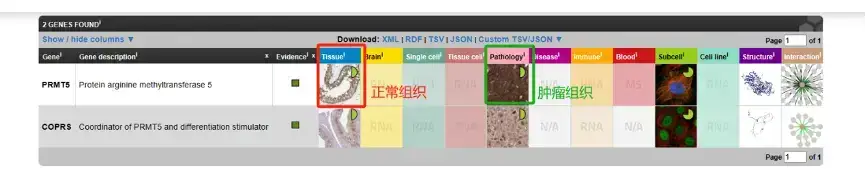 解忧小工具|让HPA验证你的结论,生信文章好帮手